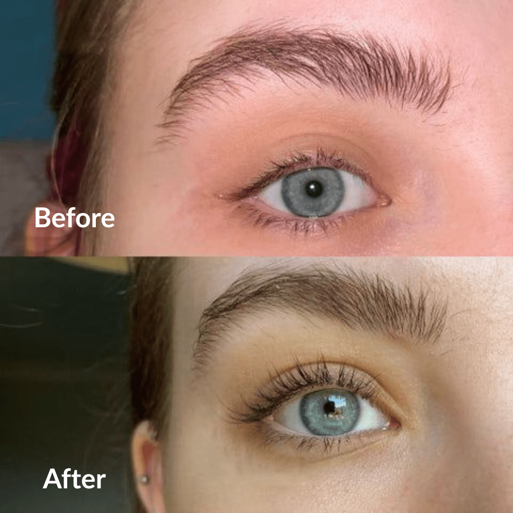 Eyelash Growth Serum