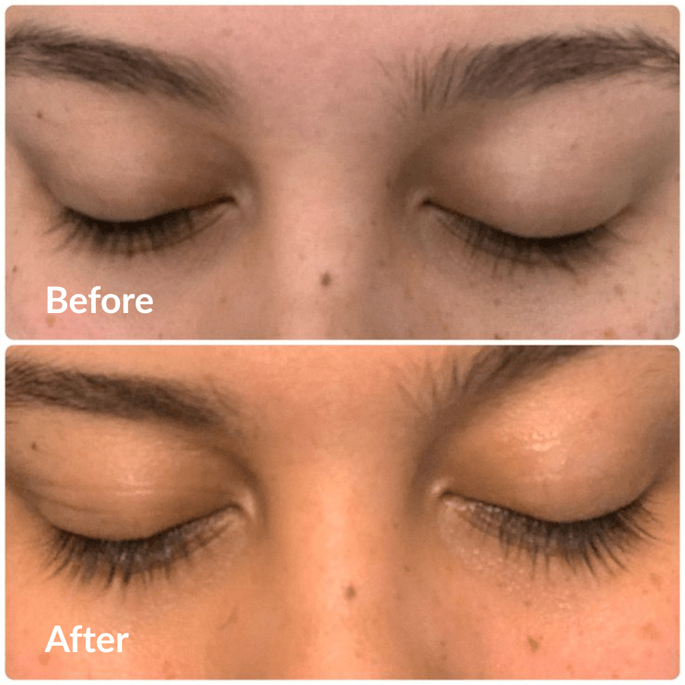 Eyelash Growth Serum